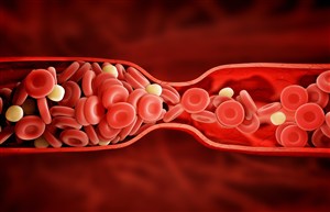 血管中拥堵的红细胞高清图片