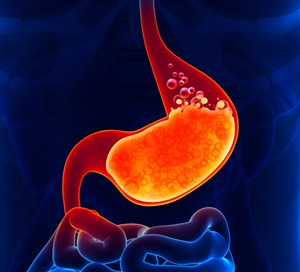 人体器官胃图片